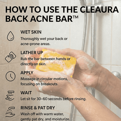 Back Acne Removal Bar